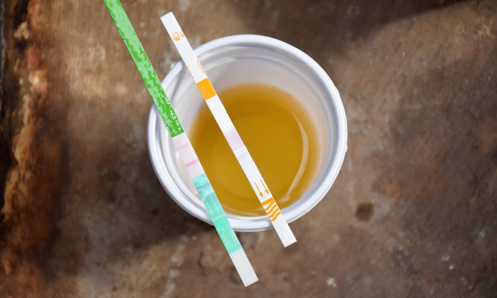 How Long Does THC Stay In Your Urine?