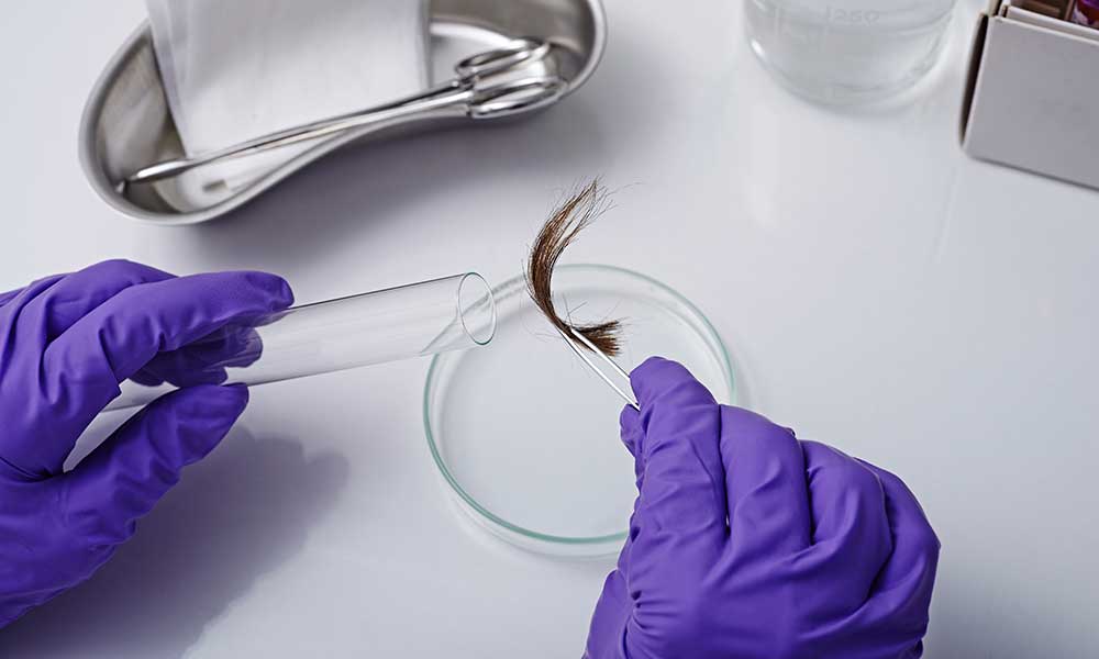 How to Pass a Hair Follicle Drug Test | High Times