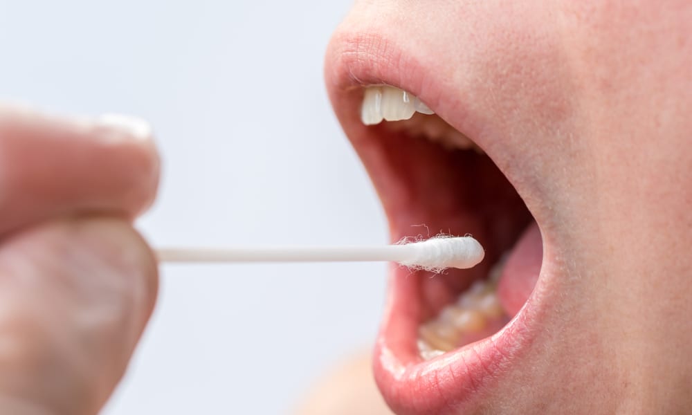 What To Do When You Have Cotton Mouth